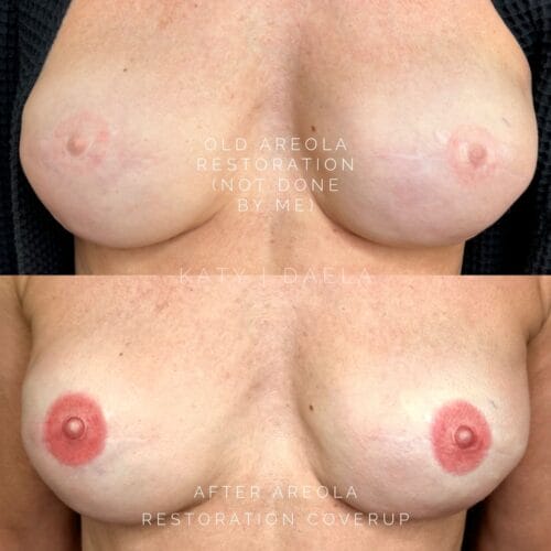 Areola Restoration Tattoo at DAELA Scottsdale