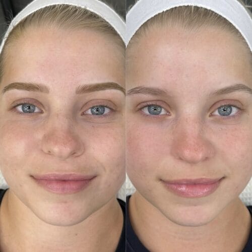 Nanoblading in Scottsdale by Chloe at DAELA Cosmetic Tattoo