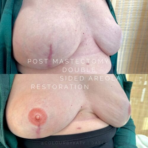 Areola Restoration Tattoo at DAELA Scottsdale by Katy