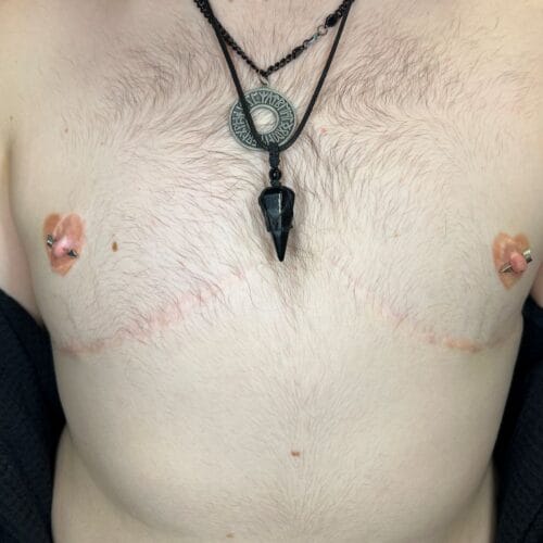Areola Restoration in Portland at DAELA by Lina