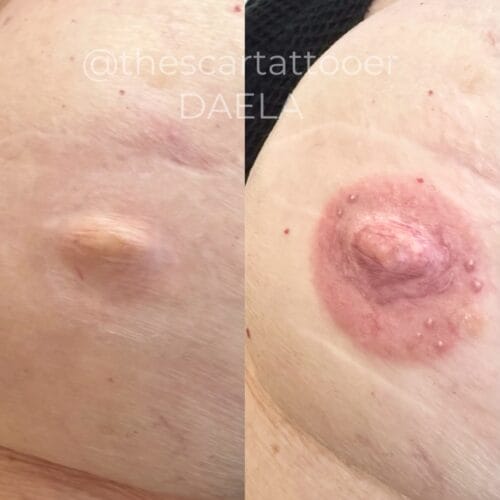 Areola Restoration tattoo in Portland at DAELA by Shonna