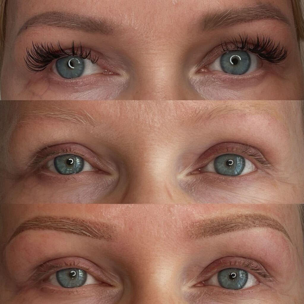 Cosmetic Laser Tattoo Removal at DAELA Portland by Bella