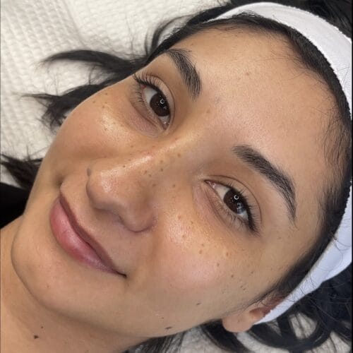 Freckles DAELA Cosmetic Tattoo Scottsdale- Chloe