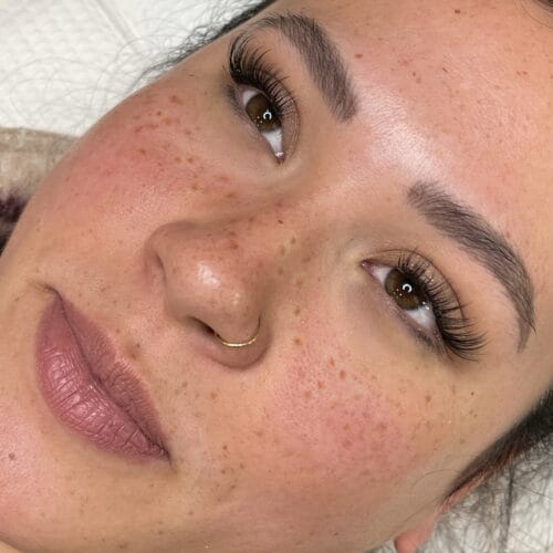 Freckles DAELA Cosmetic Tattoo Scottsdale- Chloe