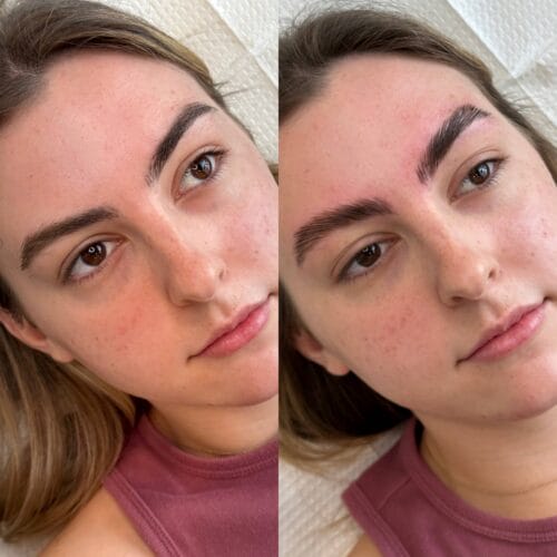 Brow Lamination