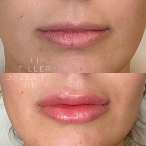 Lip Filler Tattoo at DAELA Cosmetic Tattoo Portland