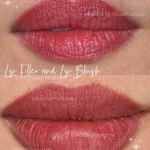 Filler and Lip Blush Tattoo at DAELA Cosmetic Tattoo Portland