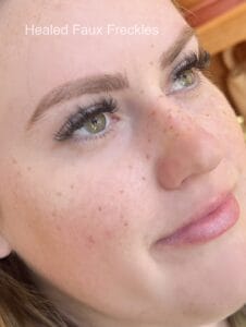 healed faux freckles allyssa
