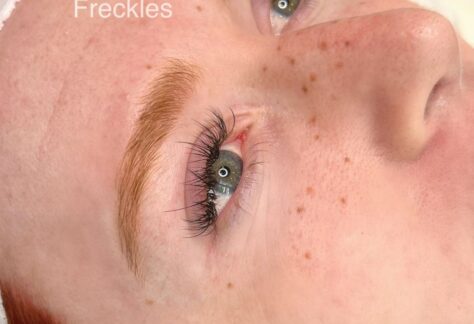 healed faux freckles allysssa