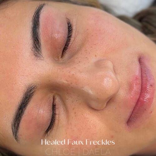 Healed Faux Freckles at DAELA Scottsdale