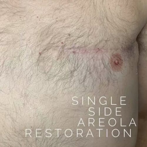 Areola Restoration Tattoo Vancouver DAELA Lina