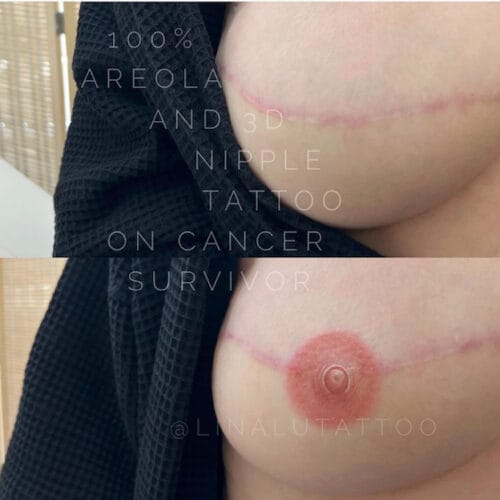 Areola Restoration Tattoo Portland DAELA Lina