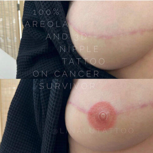 Areola Restoration Tattoo Vancouver DAELA Lina