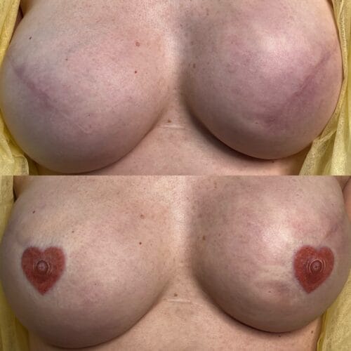 Heart Areola Restoration Tattoo Portland DAELA Lina