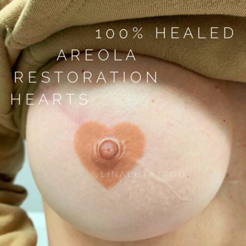Areola Restoration Tattoo Vancouver DAELA Lina