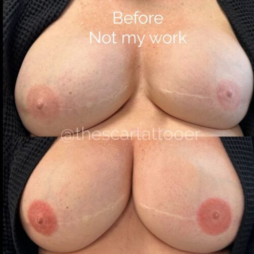 Areola Restoration Tattoo Vancouver DAELA Shonna