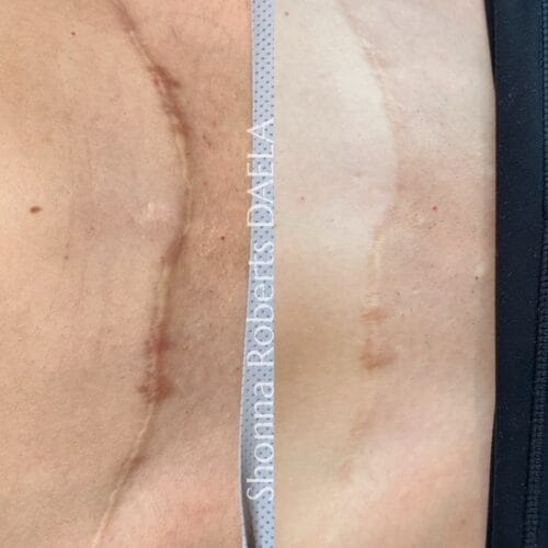 Scar Camouflage in Portland at DAELA by Shonna