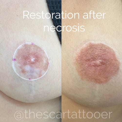 Nipple Tattoo in Portland DAELA Cosmetic Tattoo