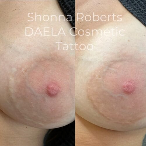 Areola Restoration tattoo in Portland Oregon