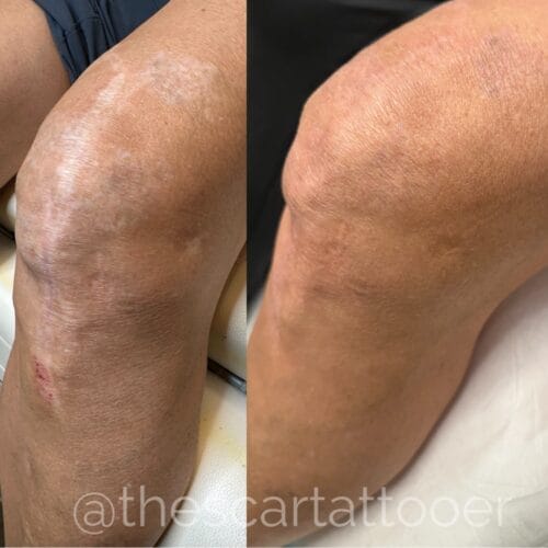 Scar Camouflage Portland DAELA Shonna