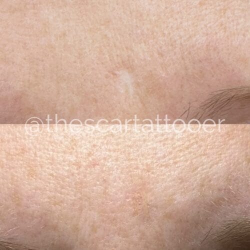 Scar Camouflage Portland DAELA Shonna