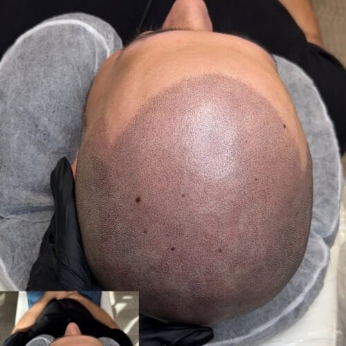 Mens SMP Touchup at DAELA Cosmetic Tattoo