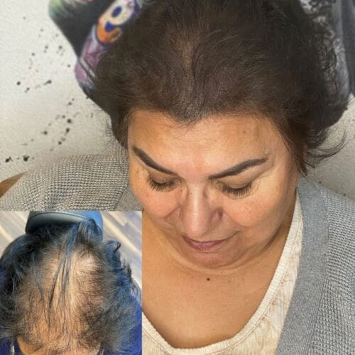 Scalp Micropigmentation Density for Women at DAELA Cosmetic Tattoo