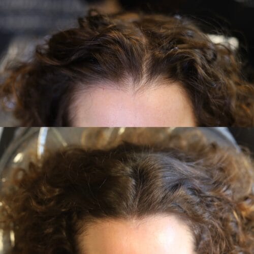 Scalp Micropigmentation Density for Women at DAELA Cosmetic Tattoo