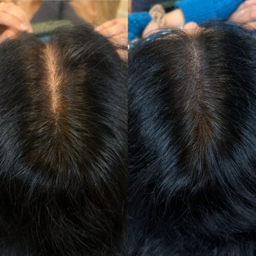 Scalp Micropigmentation Density for Women at DAELA Cosmetic Tattoo