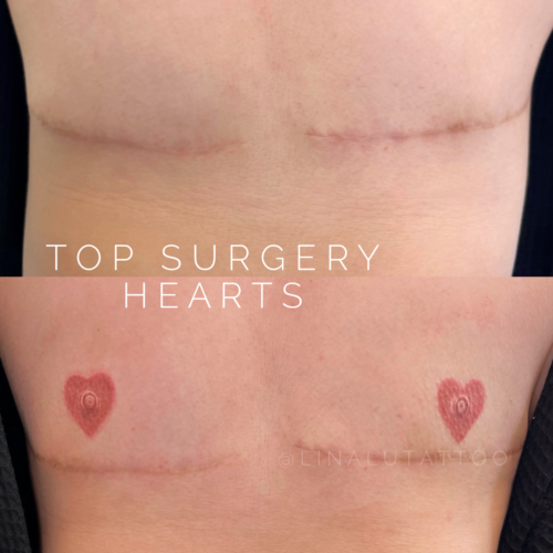 Mens Areola Restoration Tattoo Portland DAELA Lina