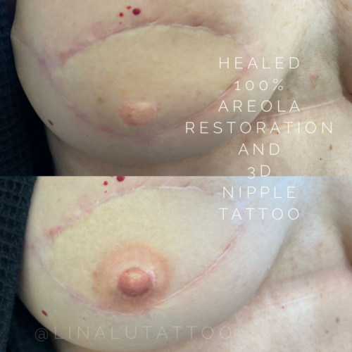 Areola Restoration Tattoo Portland DAELA Lina