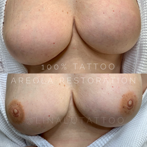 Areola Restoration Tattoo Portland DAELA Lina